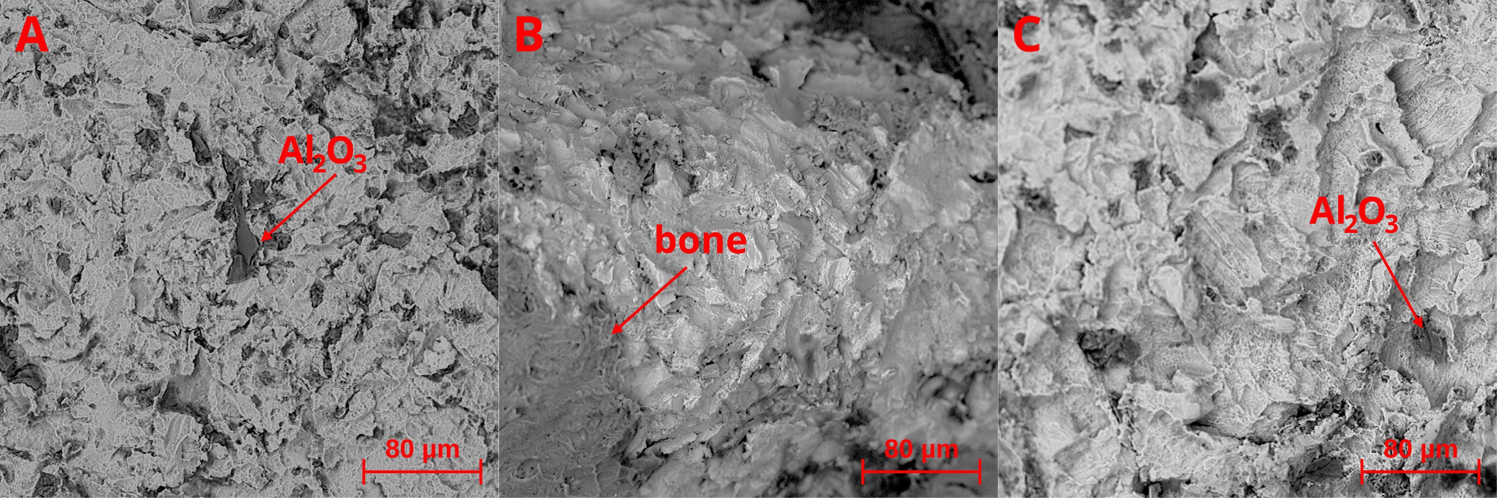 SEM micrographs of explanted implants without evident corrosion-related findings